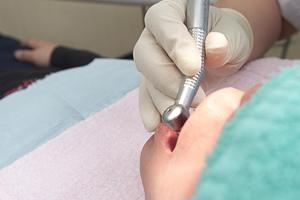 歯科医師が語る！インプラント治療の魅力と南大阪で受けられる最高のオプション