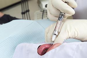 歯周病予防のためのステップバイステップガイド