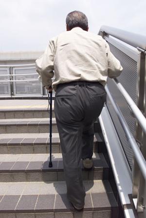 健康で美しい歯が手に入るインプラント